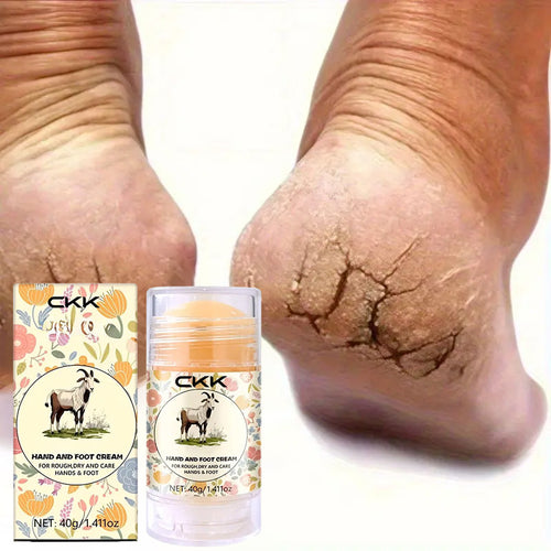 Foot cream for cracked heels