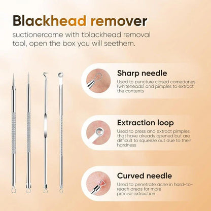 Rechargeable Pore Vacuum – 6-in-1 Blackhead Remover with Smart Display & Extraction Kit