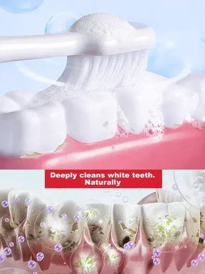 🔥Nicotinamide Probiotic Whitening Toothpaste - Free of Fluoride, Nicotinamide, Anti plaque