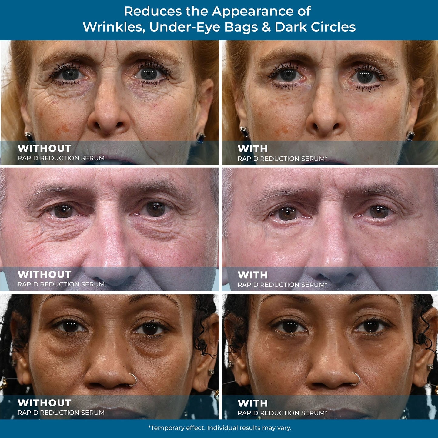 Rapid Reduction Serum – Buy 2 Get 1 Free