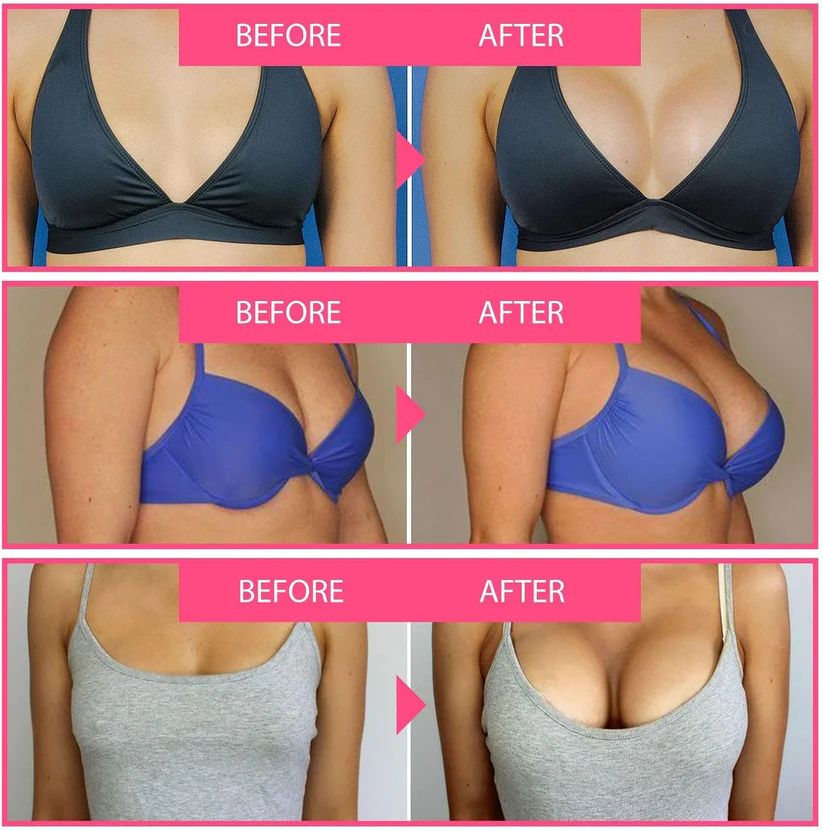 💰Free Shipping📦Bee Venom Lift Cream