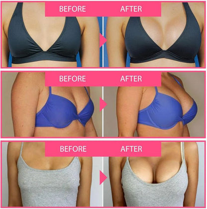 💰Free Shipping📦Bee Venom Lift Cream