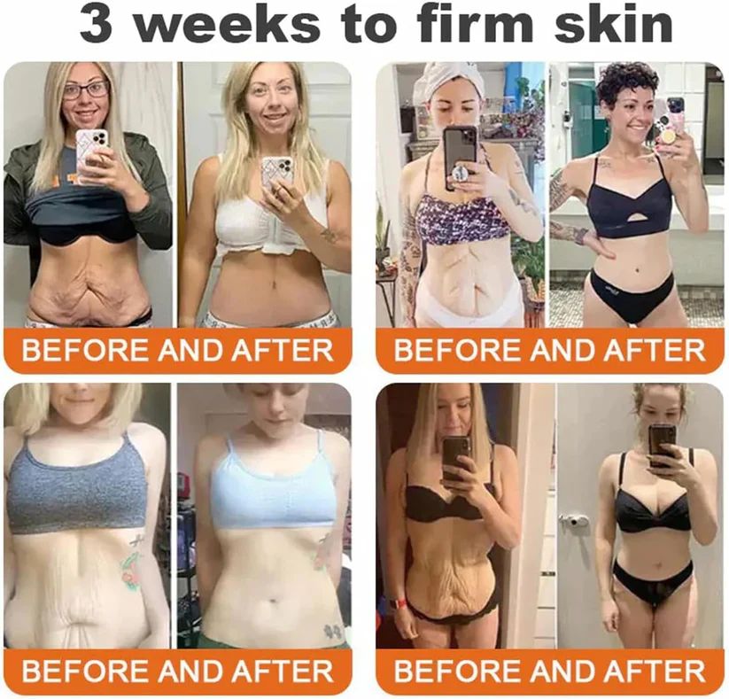 💰Free Shipping📦Bee Venom Lift Cream