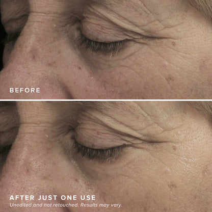 🔥Free Shipping📦Brightening Eye Masks