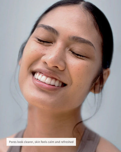 💰Free Shipping📦NOSE PATCHES