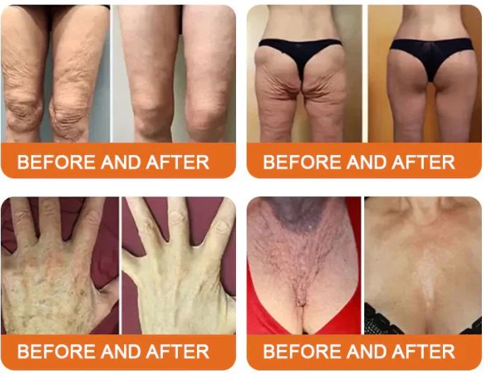 💰Free Shipping📦Bee Venom Lift Cream