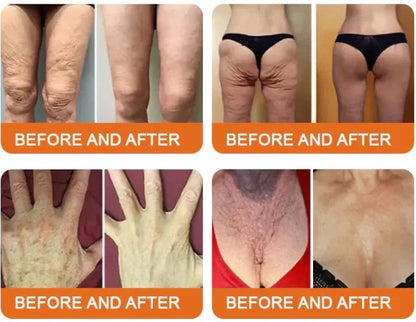 💰Free Shipping📦Bee Venom Lift Cream