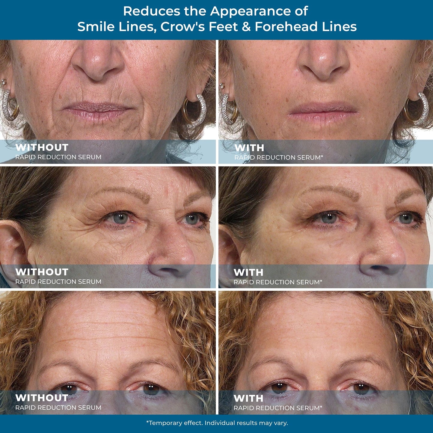 Rapid Reduction Serum – Buy 2 Get 1 Free