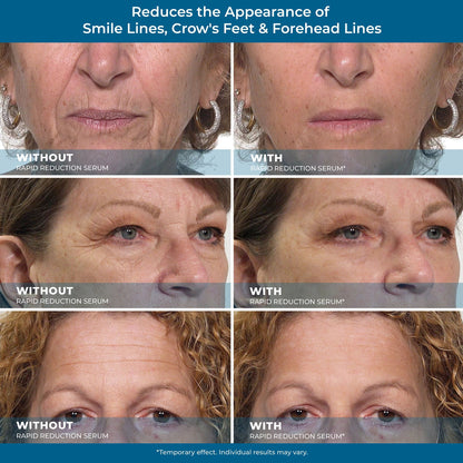 Rapid Reduction Serum – Buy 2 Get 1 Free